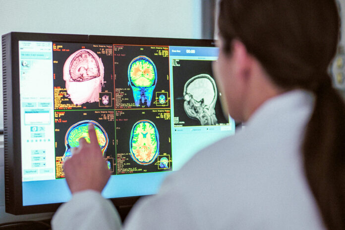 mysterious-brain-diseases-in-canada-weren’t-a-mystery-after-all