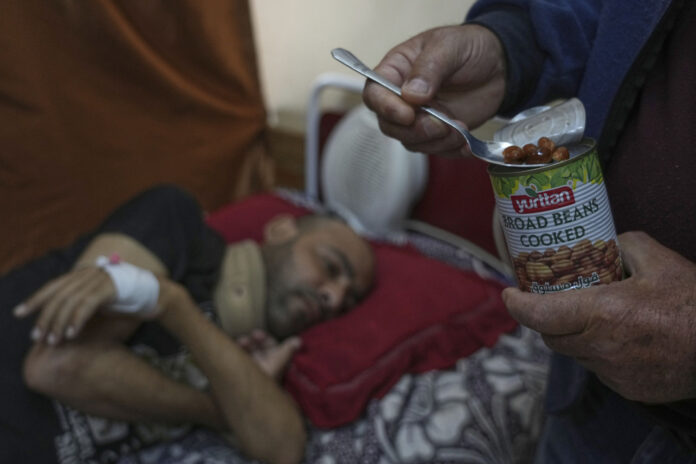 israeli-block-means-that-gaza-hospitals-cannot-provide-food-for-recovery-patients